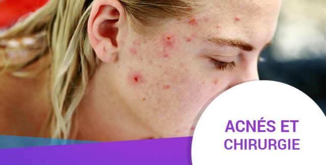 ACNÉS ET CHIRURGIE ACNÉS ET CHIRURGIE