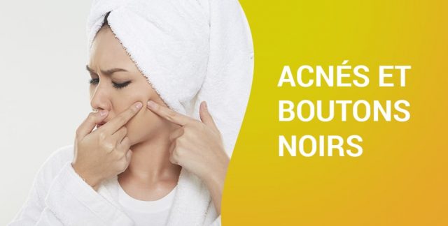 ACNÉS ET BOUTONS NOIRS