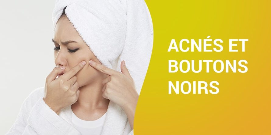 ACNÉS ET BOUTONS NOIRS ACNÉS ET BOUTONS NOIRS