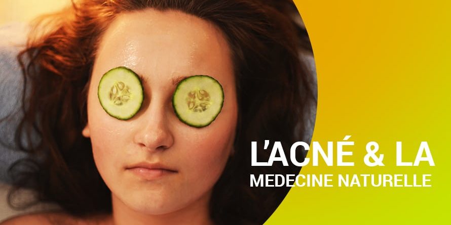 L’ACNÉ & LA MEDECINE NATURELLE