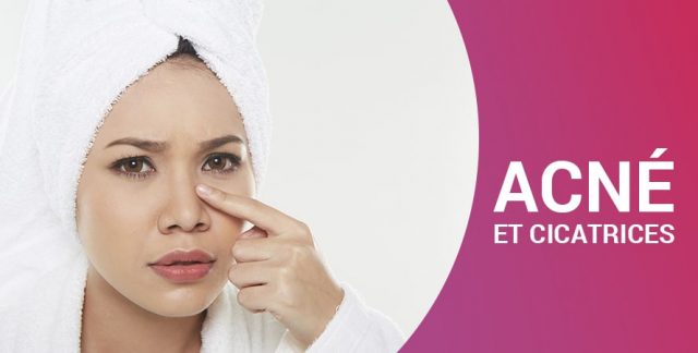 ACNÉ ET CICATRICES