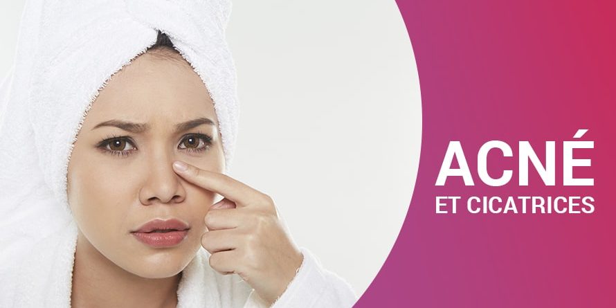 ACNÉ ET CICATRICES ACNÉ ET CICATRICES
