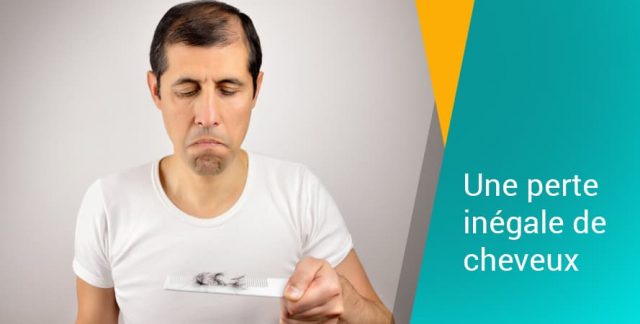 Une perte inégale de cheveux
