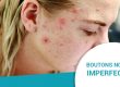 BOUTONS NOIRS ET IMPERFECTIONS